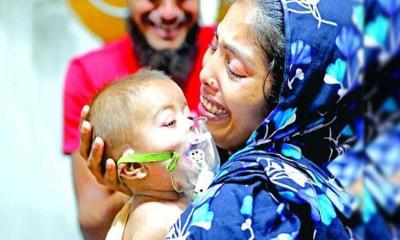 হাম ও উপসর্গে শিশু মৃত্যু ৯০০ ছুঁই ছুঁই