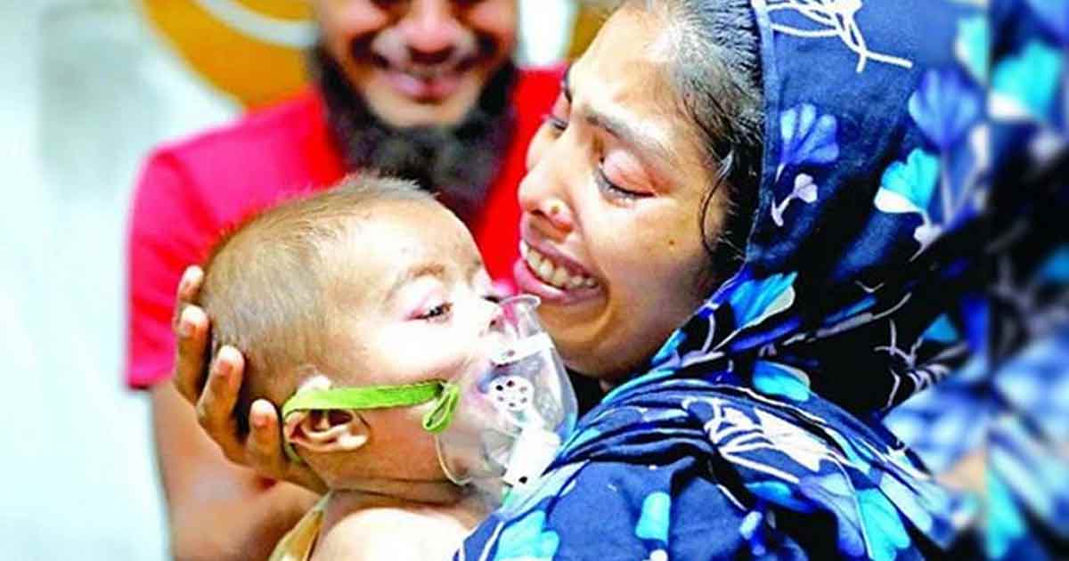 হামের প্রকোপে এক দিনে আরও ৪ শিশুর মৃত্যু