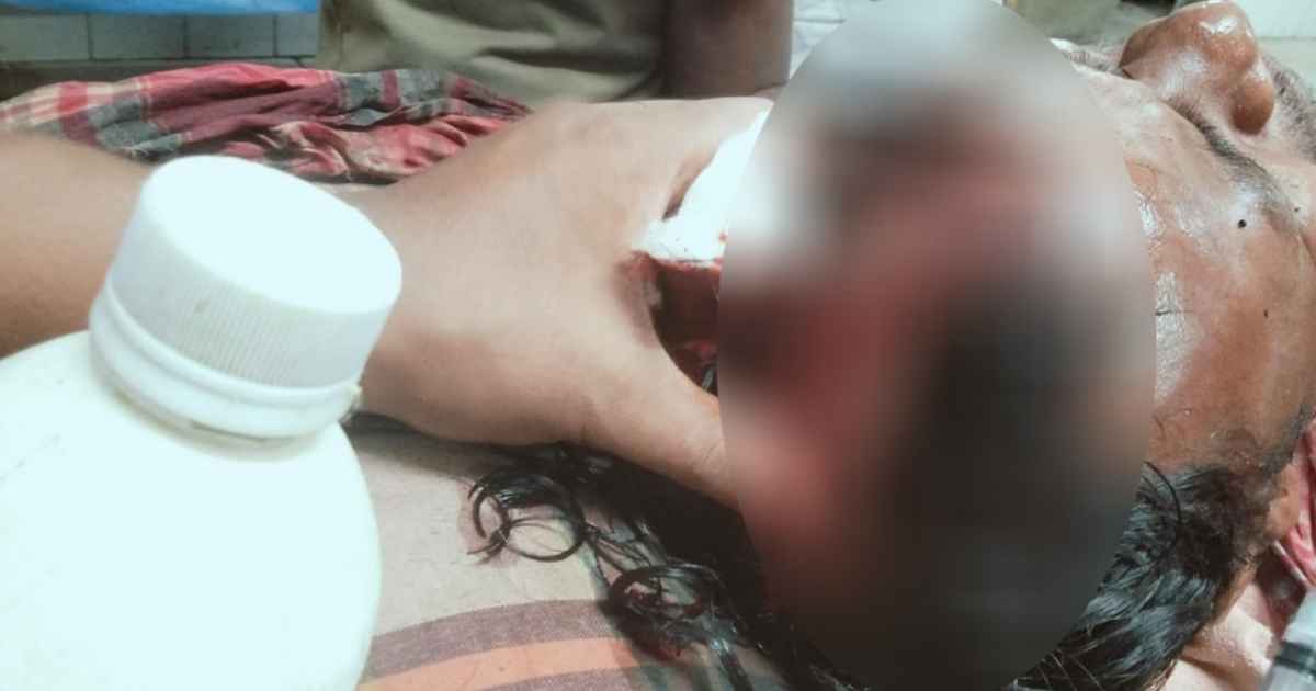রাতে পাহারায় থাকা পাঁচ চা-শ্রমিককে মারধরের অভিযোগ