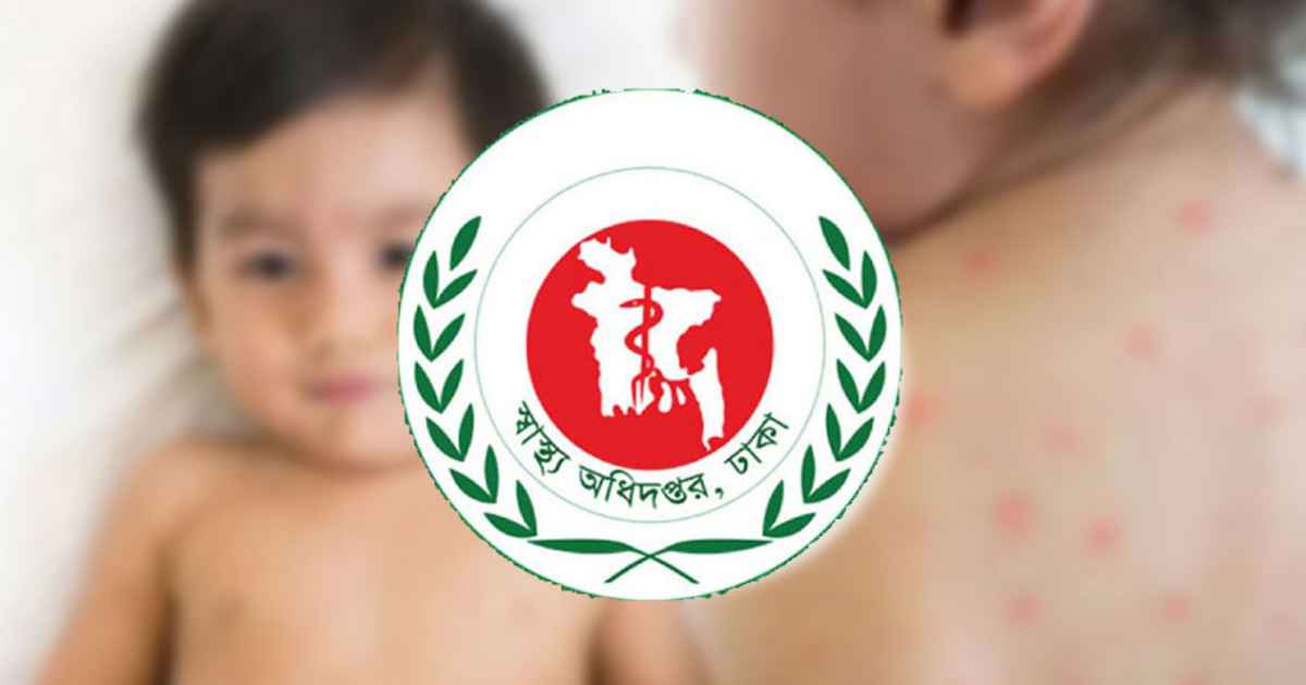 হামের উপসর্গে এক দিনে ছয় শিশুর মৃত্যু